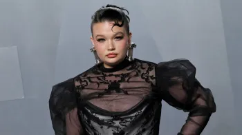 Lola Young disse que est� sentindo os efeitos do vape (Foto: Astrida Valigorsky/Getty Images)