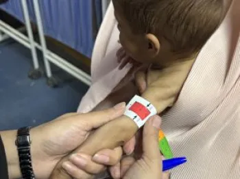 Enfermeiro de MSF mede o bra�o de um beb� com desnutri��o em cl�nica no sul do Afeganist�o. (Foto: Nazia Kamal/MSF)