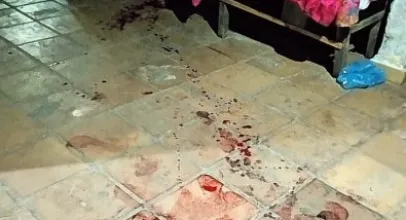 Mulher esfaqueia o marido ap�s ser agredida em briga por ci�mes