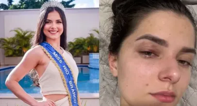 Homem � culpado por bater em antiga rainha de beleza do Acre por ci�mes