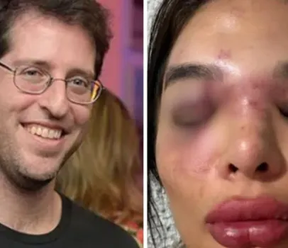 Dentista conta como sofria agress�es e amea�as do marido, que est� preso