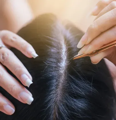Arrancar cabelo branco faz nascer mais fios? Dermatologista esclarece