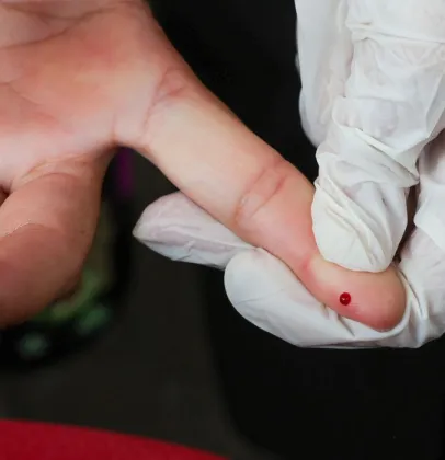 Brasil bate meta e reduz transmiss�o de hepatite B de m�e para filho
