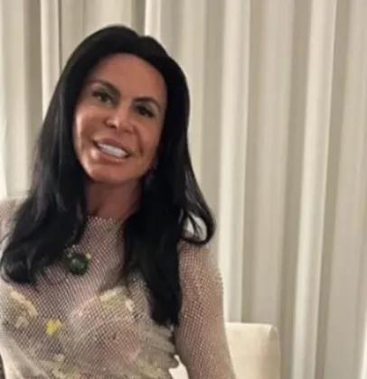 Gretchen revela transforma��o ap�s transplante capilar: 'Estou linda de novo'
