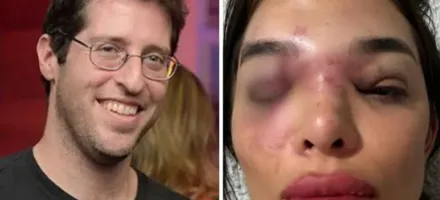 Dentista conta como sofria agress�es e amea�as do marido, que est� preso