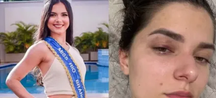 Homem � culpado por bater em antiga rainha de beleza do Acre por ci�mes