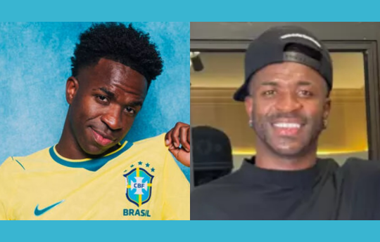 Vini Jr. muda o rosto e surpreende f�s com harmoniza��o facial