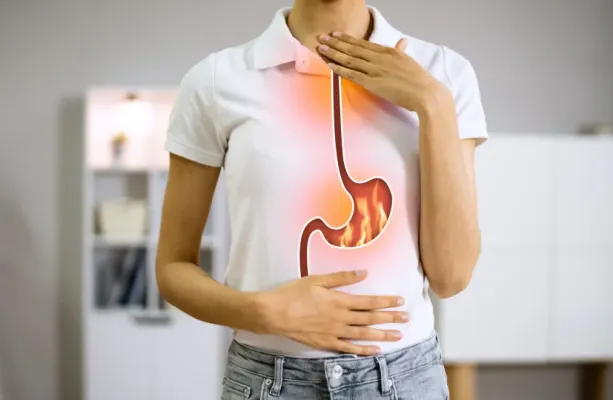 M�dicos revelam os piores alimentos para quem sofre de azia