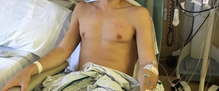 Joe Manganiello revela fotos chocantes de hospital ap�s amputa��o e perda de 60 kg