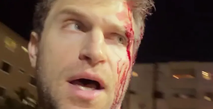 Ator de Pretty Little Liars � atacado a tiros e facadas em estacionamento nos EUA