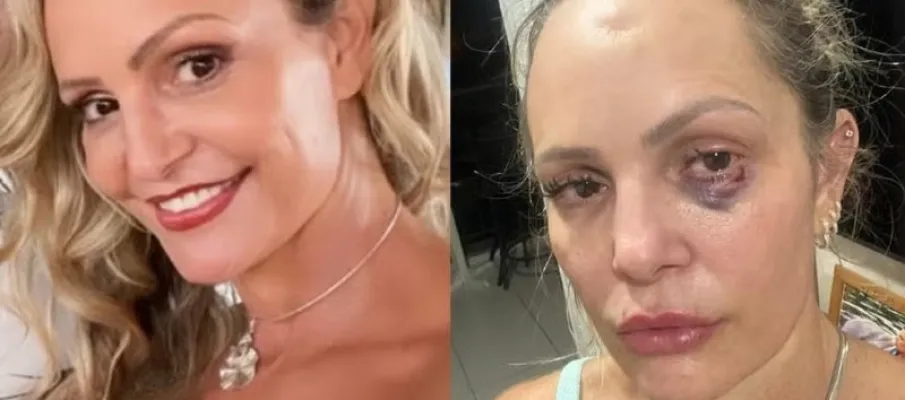 Personal diz que era obrigada a realizar sexo anal no ex-companheiro policial; veja o v�deo