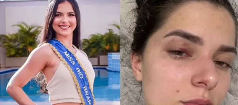 Homem � culpado por bater em antiga rainha de beleza do Acre por ci�mes