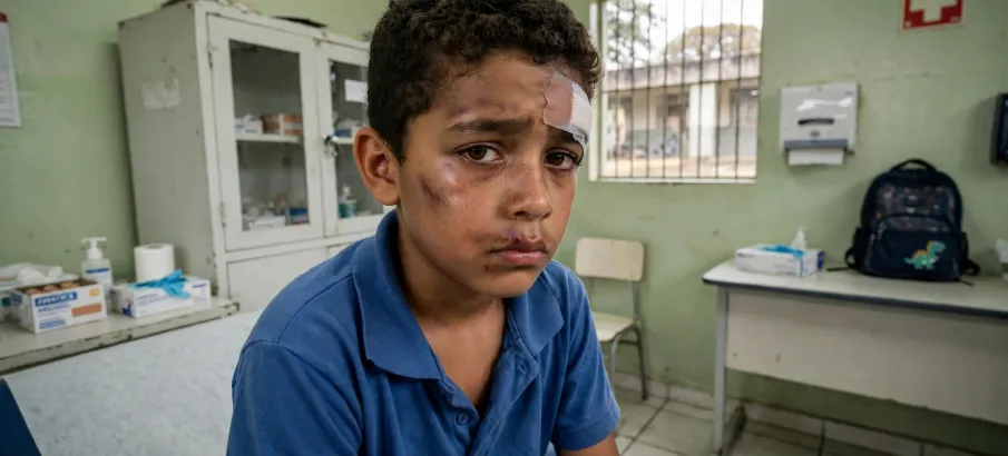 Garoto de 10 anos sofre agress�o grave em escola p�blica no Cear� e pol�cia investiga o caso