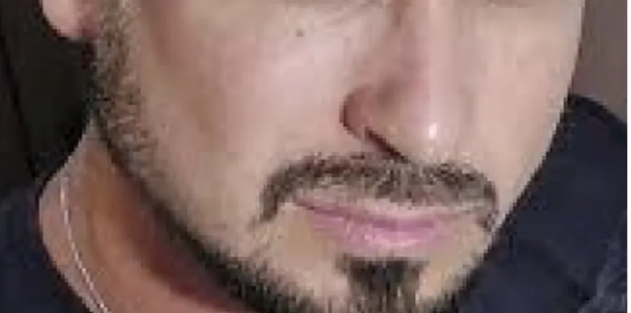 Homem de 33 anos morre aps ingerir usque adulterado com metanol